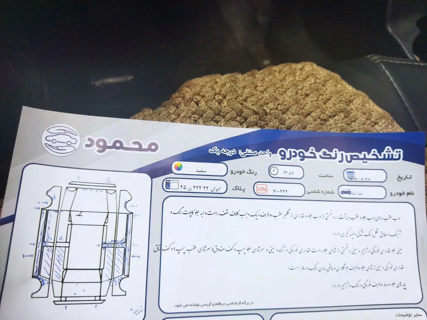 ساینا EX معمولی - 1395