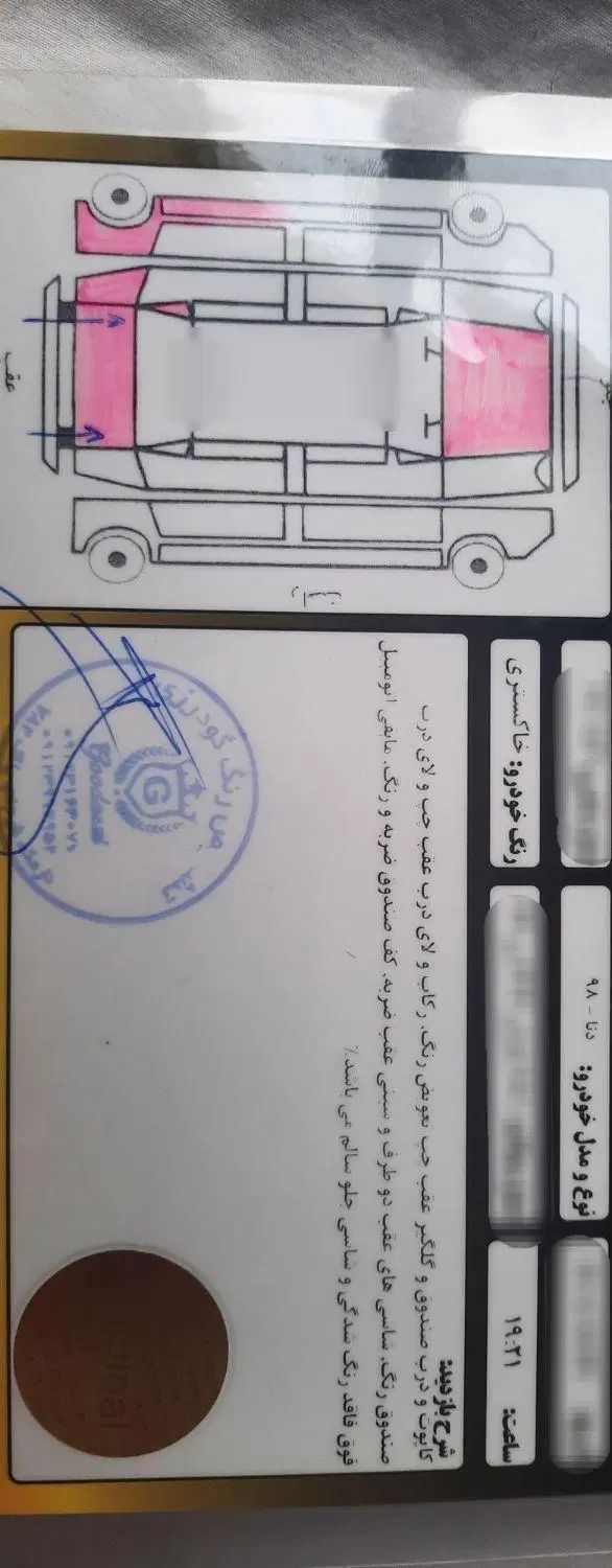 دنا معمولی تیپ ۱ - 1398