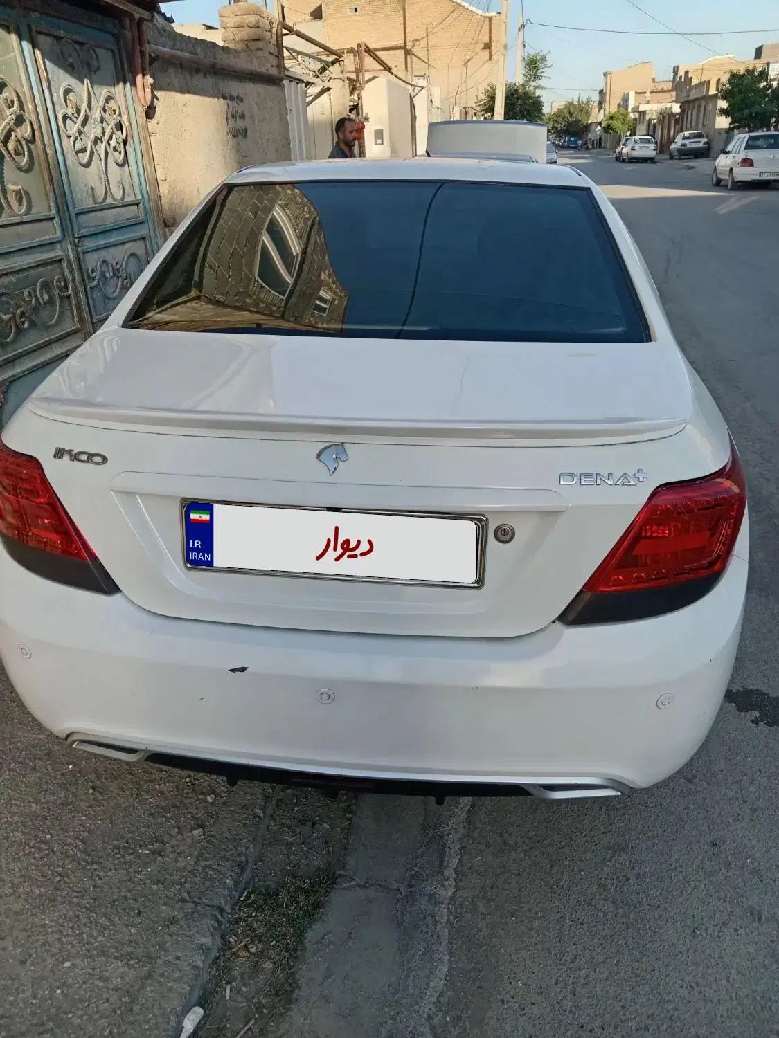 دنا معمولی تیپ ۲ - 1394