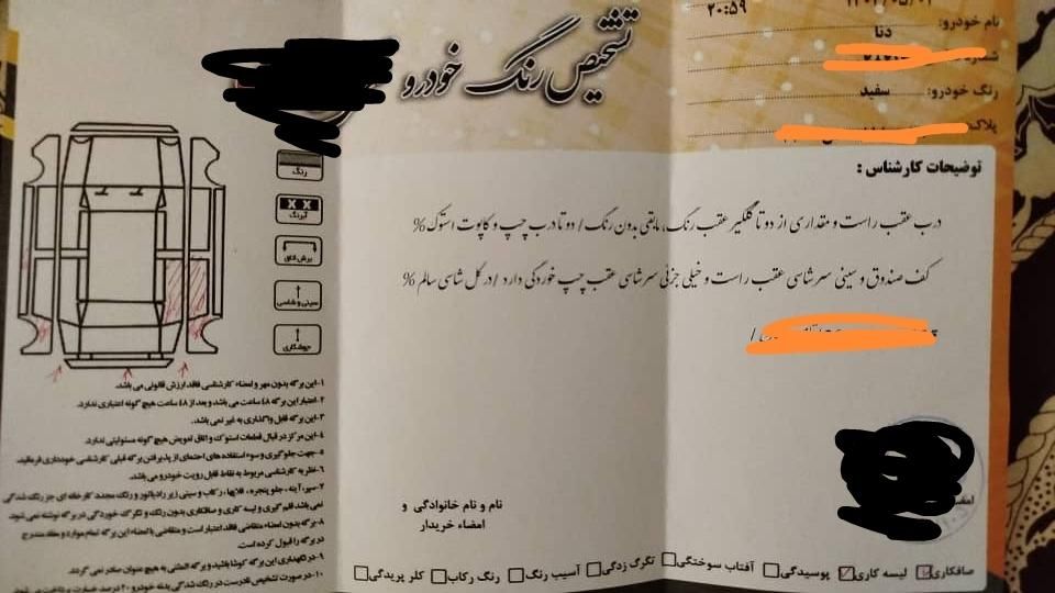 دنا معمولی تیپ ۲ - 1394