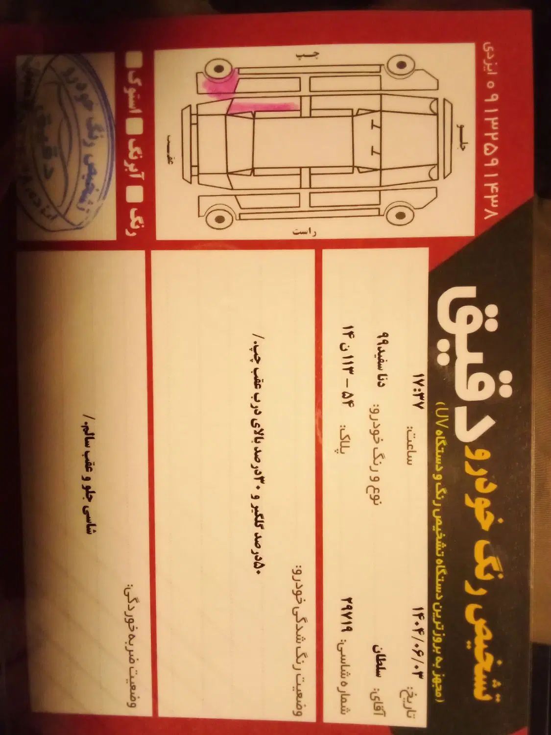 دنا معمولی تیپ ۱ - 1399