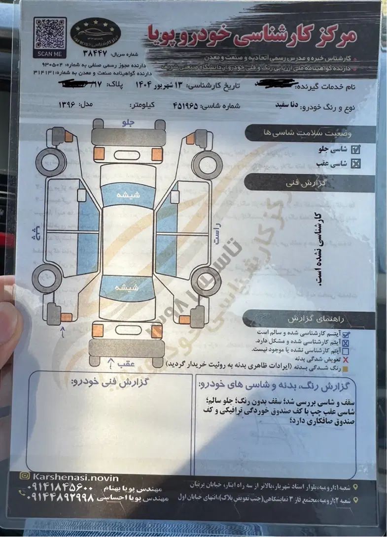 دنا معمولی تیپ ۲ - 1396