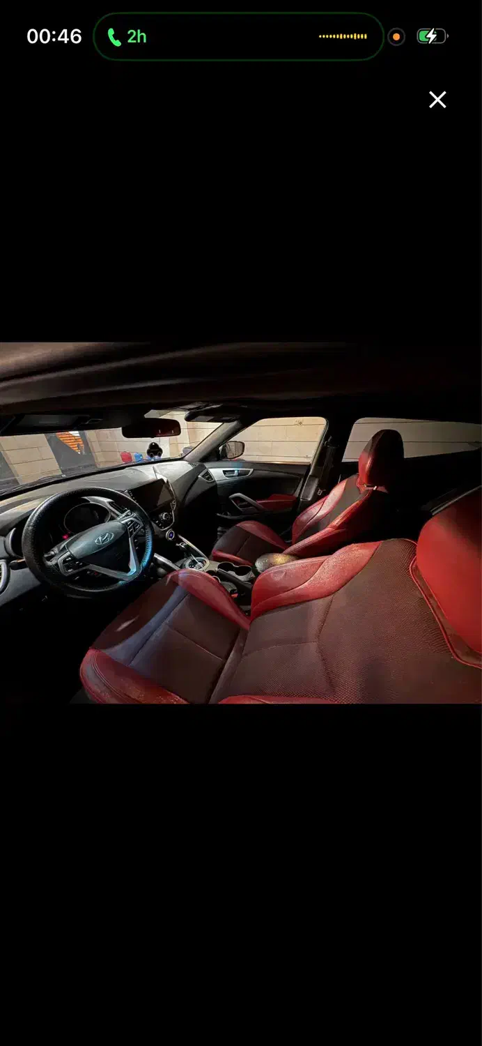 خودرو هیوندای، ولستر آگهی ann_21036087